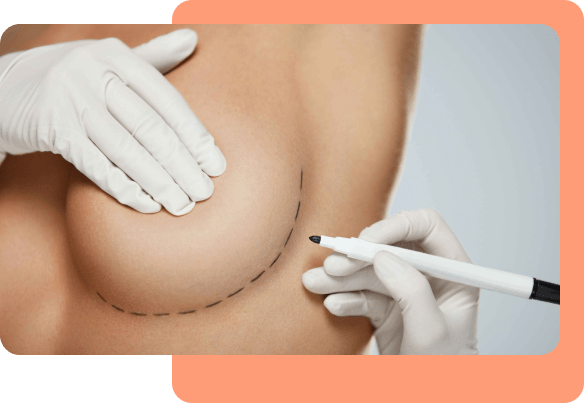 Breast-Augmentation