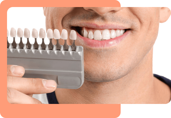 Teeth-Whitening