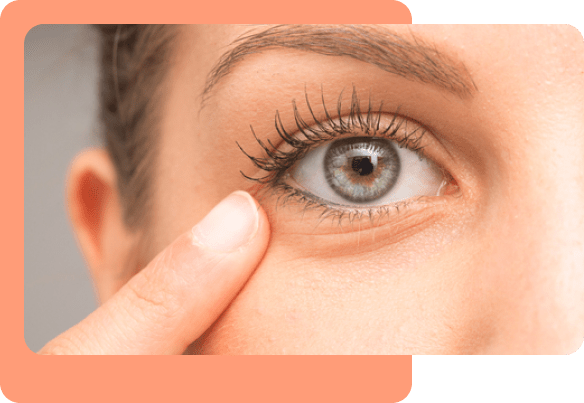 Under-Eye-Dark-Circle-Treatment